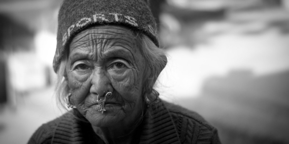Cildimizde oluşan kırışıklıklar nasıl giderilir?